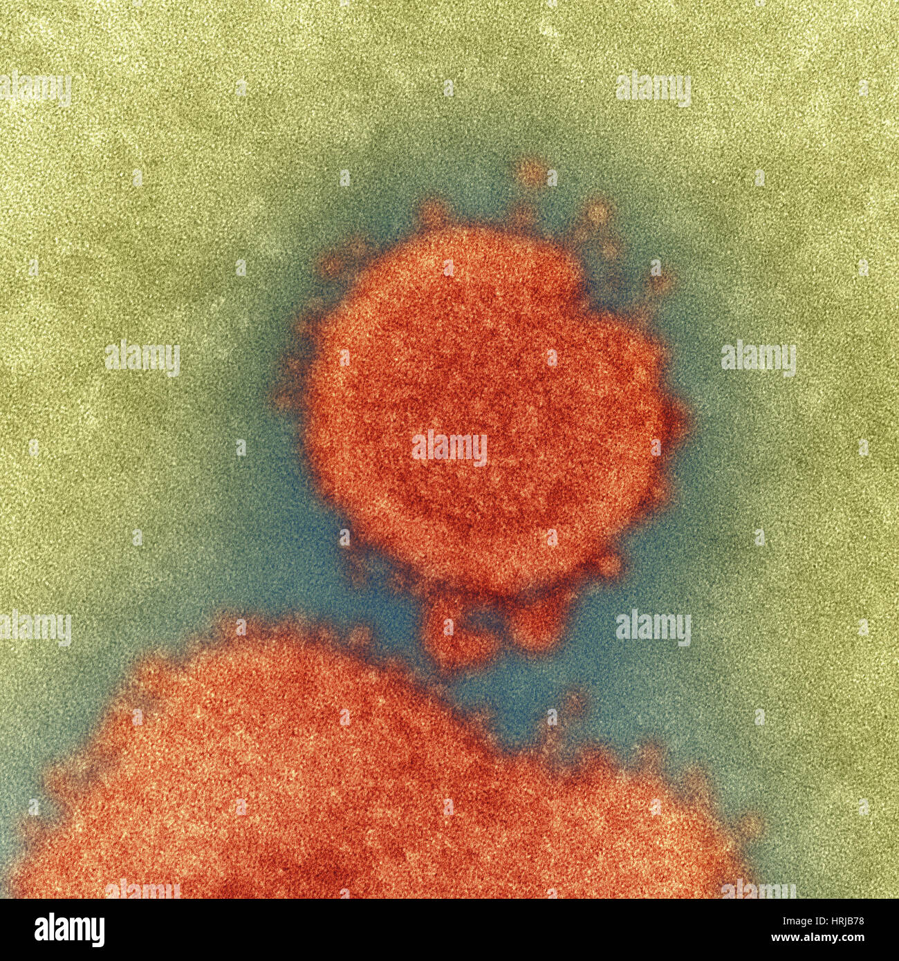 H7N9, influenza A, Virus dell influenza aviaria, TEM Foto Stock