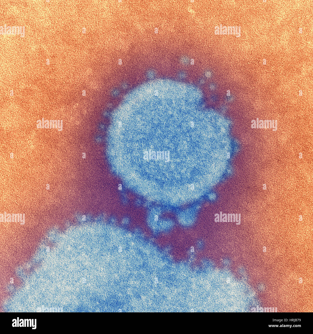 H7N9, influenza A, Virus dell influenza aviaria, TEM Foto Stock