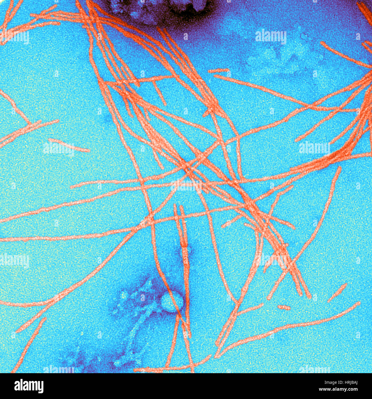 Fibrille amiloidi (TEM) Foto Stock