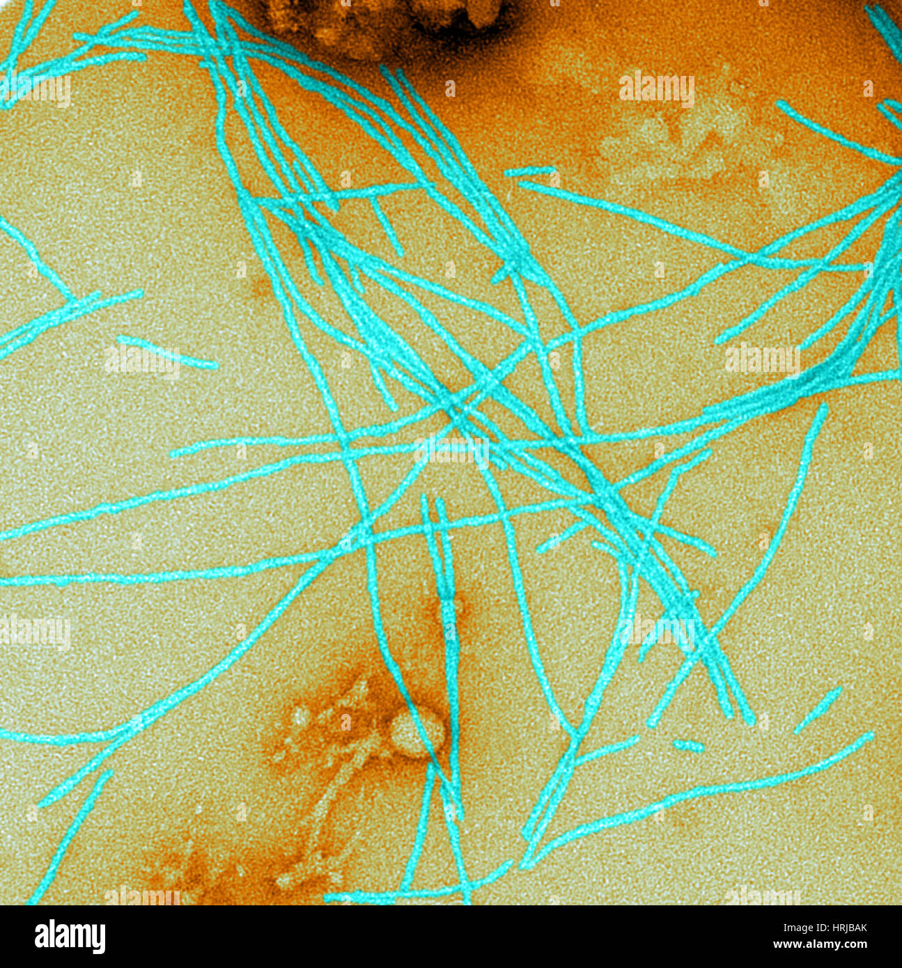 Fibrille amiloidi (TEM) Foto Stock