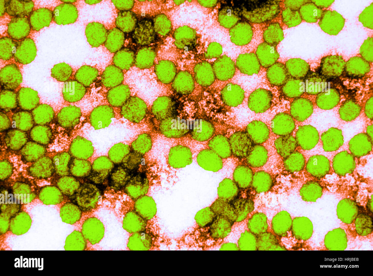 Virus della febbre gialla, TEM Foto Stock