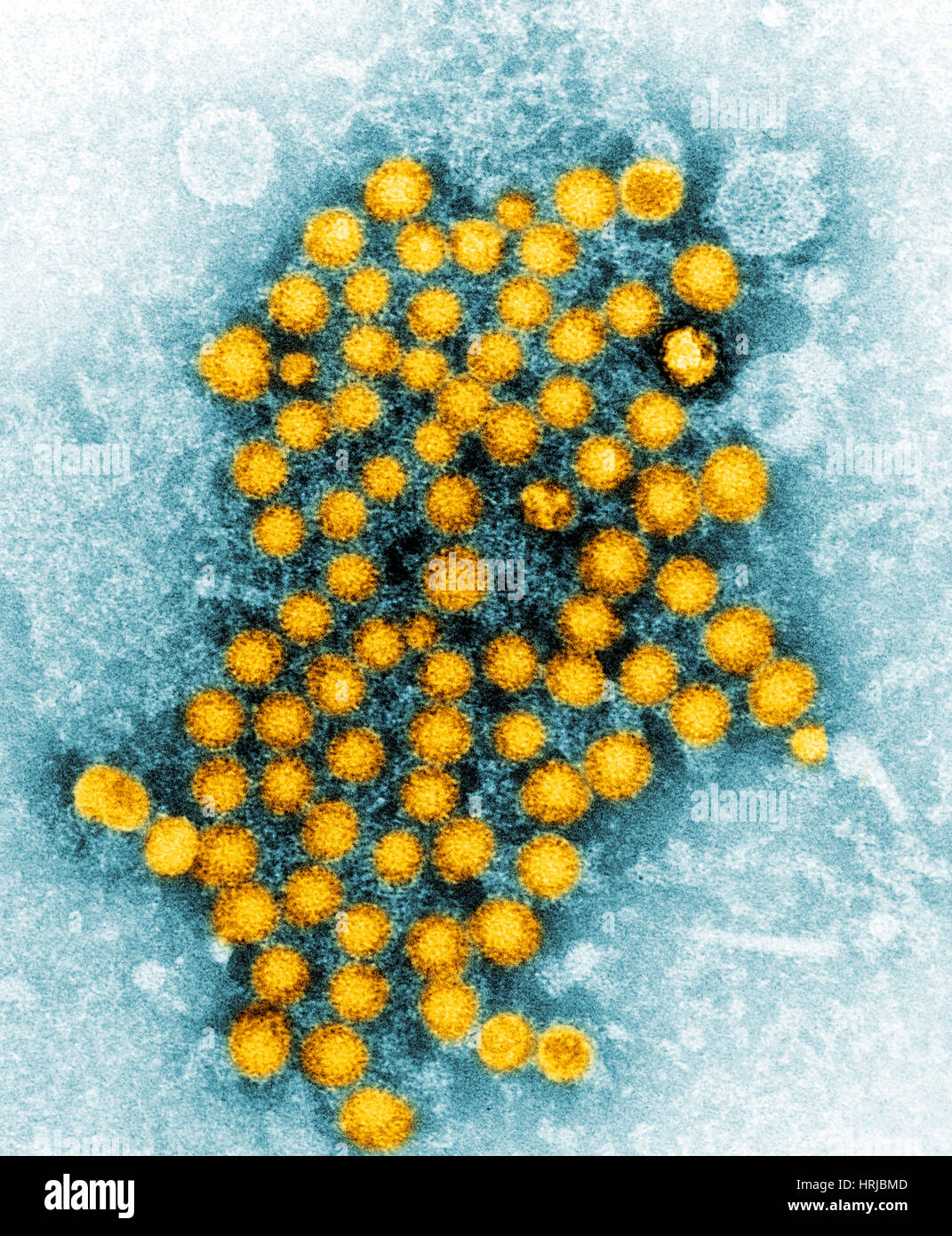 Virus di epatite, ceppo sconosciuto, TEM Foto Stock