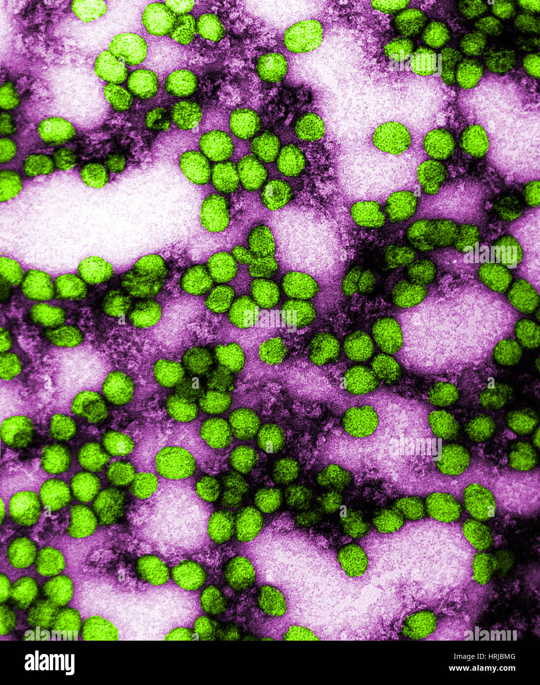 Virus della febbre gialla, TEM Foto Stock