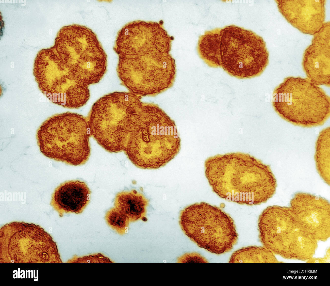 Neisseria gonorrhoeae batteri, EM Foto Stock