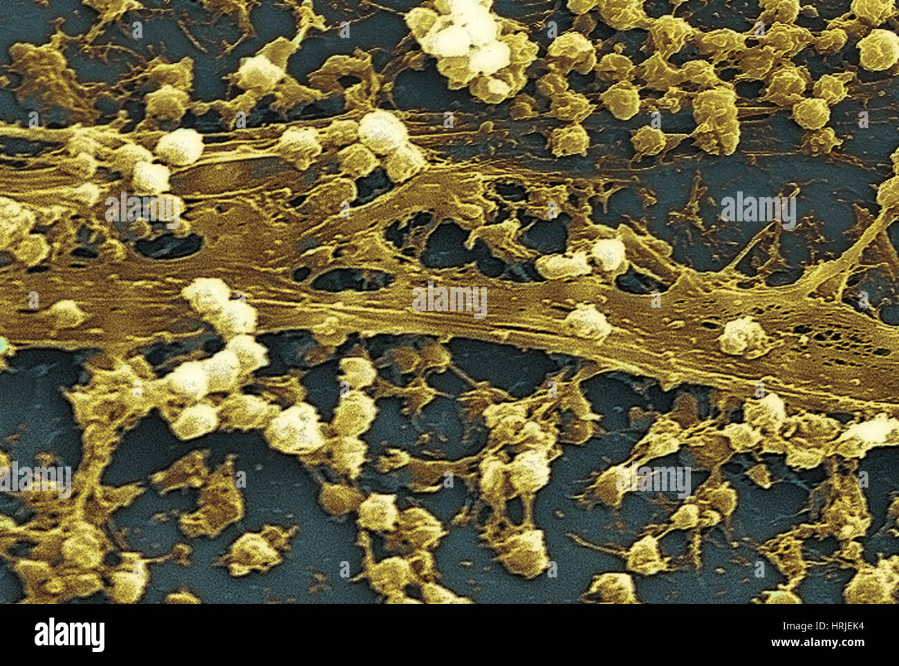 Per Staphylococcus aureus, SEM Foto Stock