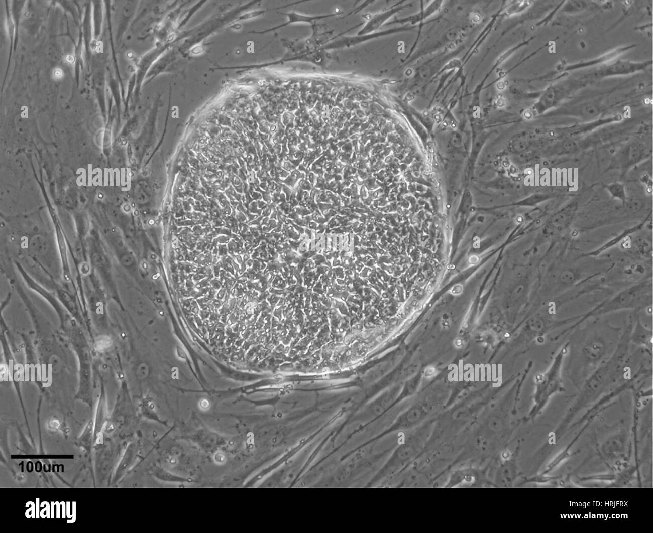 Di cellule staminali embrionali umane Linea UC06 Foto Stock