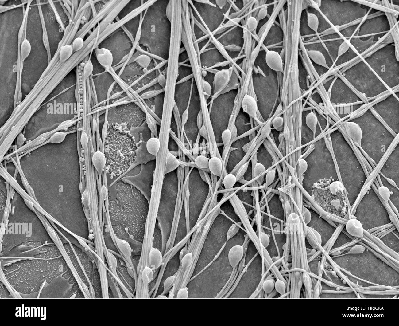 Neuroni e cellule gliali, SEM Foto Stock