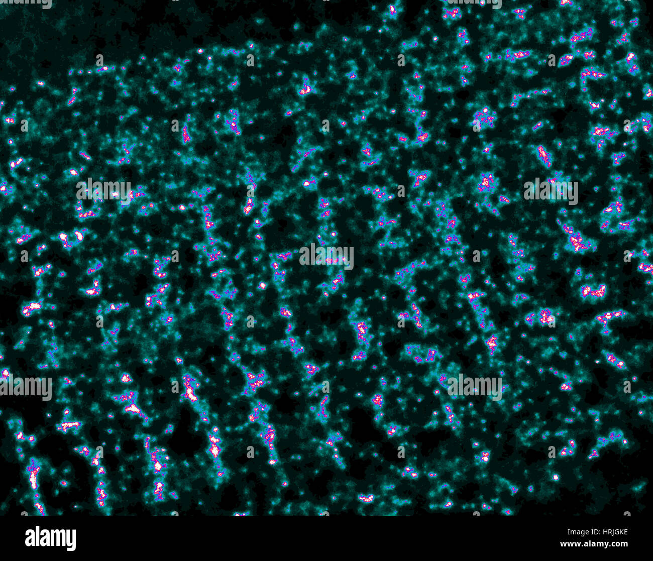 Il muscolo cardiaco, i canali del calcio, LM Foto Stock