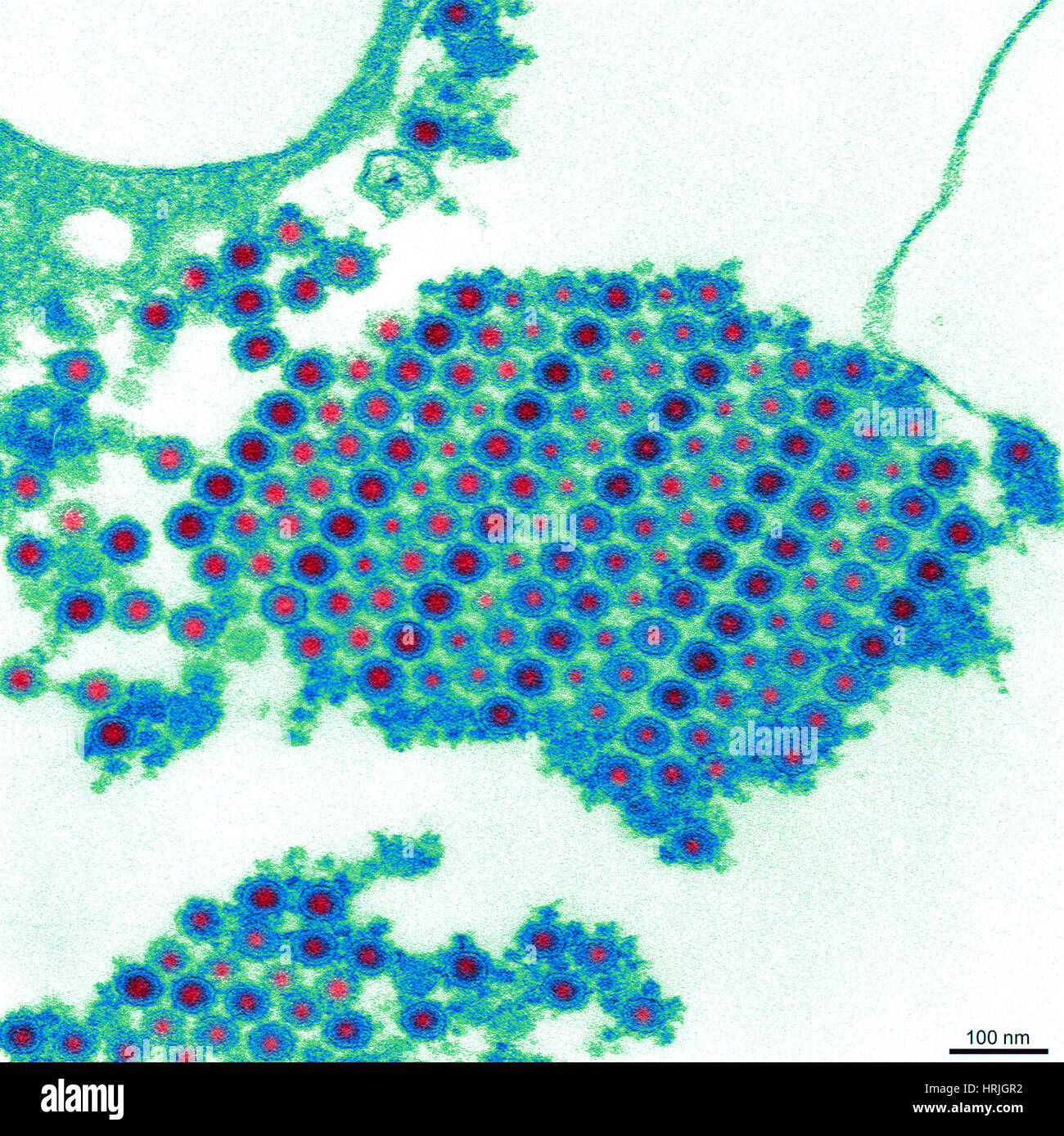 TEM del virus Chikungunya Foto Stock