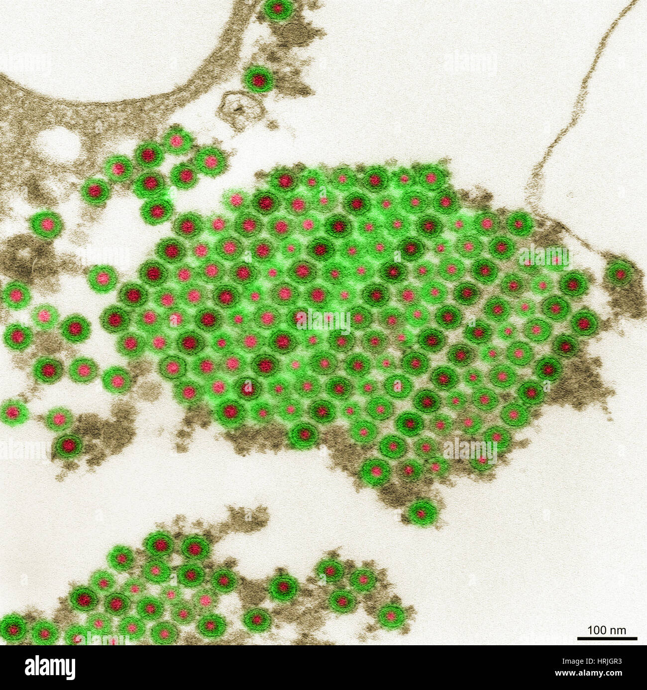 TEM del virus Chikungunya Foto Stock