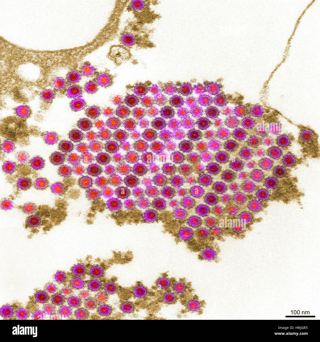 TEM del virus Chikungunya Foto Stock