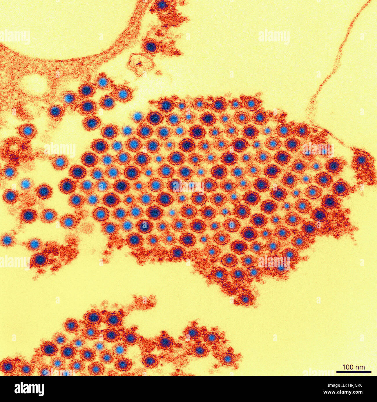 TEM del virus Chikungunya Foto Stock