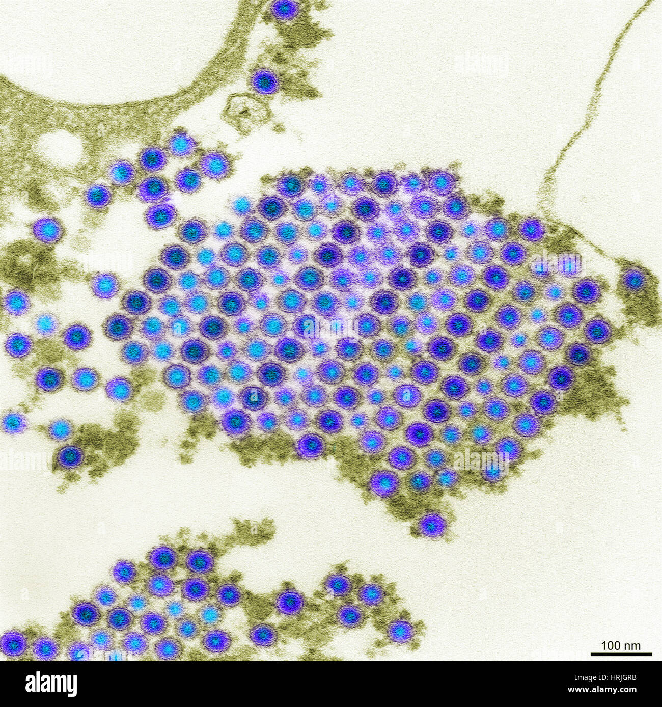 TEM del virus Chikungunya Foto Stock