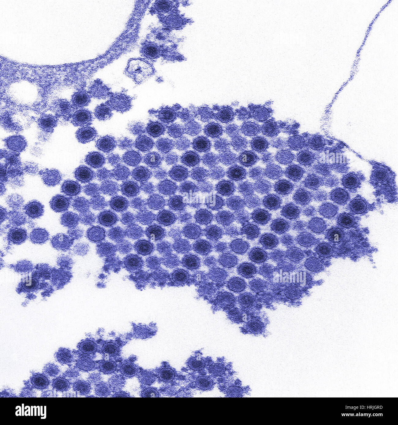 TEM del virus Chikungunya Foto Stock