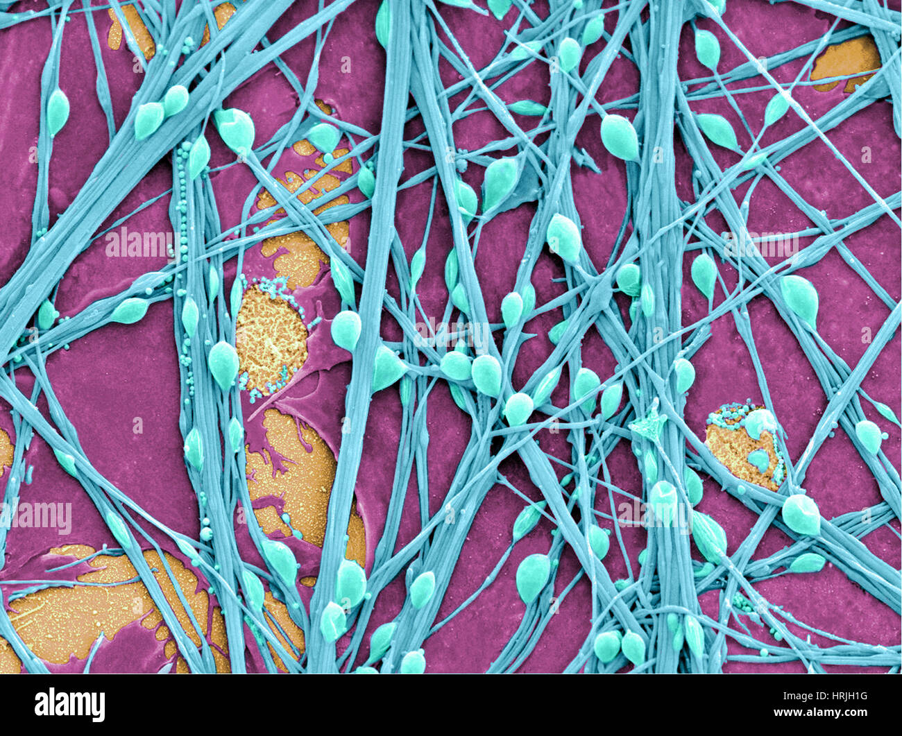 Neuroni e cellule gliali, SEM Foto Stock