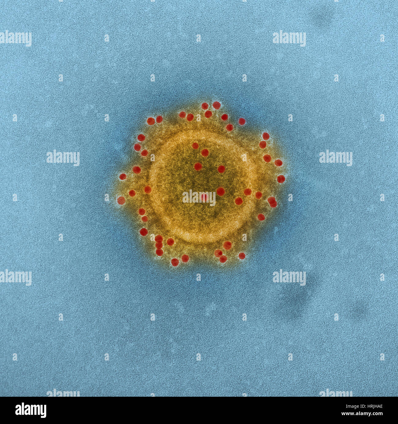 Meri Coronavirus particelle, TEM Foto Stock