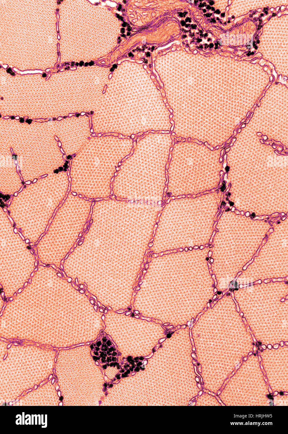 Muscolo di rana, TEM Foto Stock