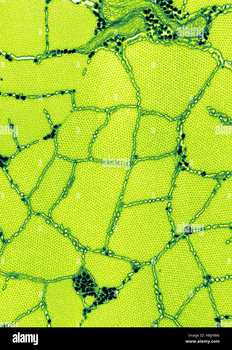 Muscolo di rana, TEM Foto Stock