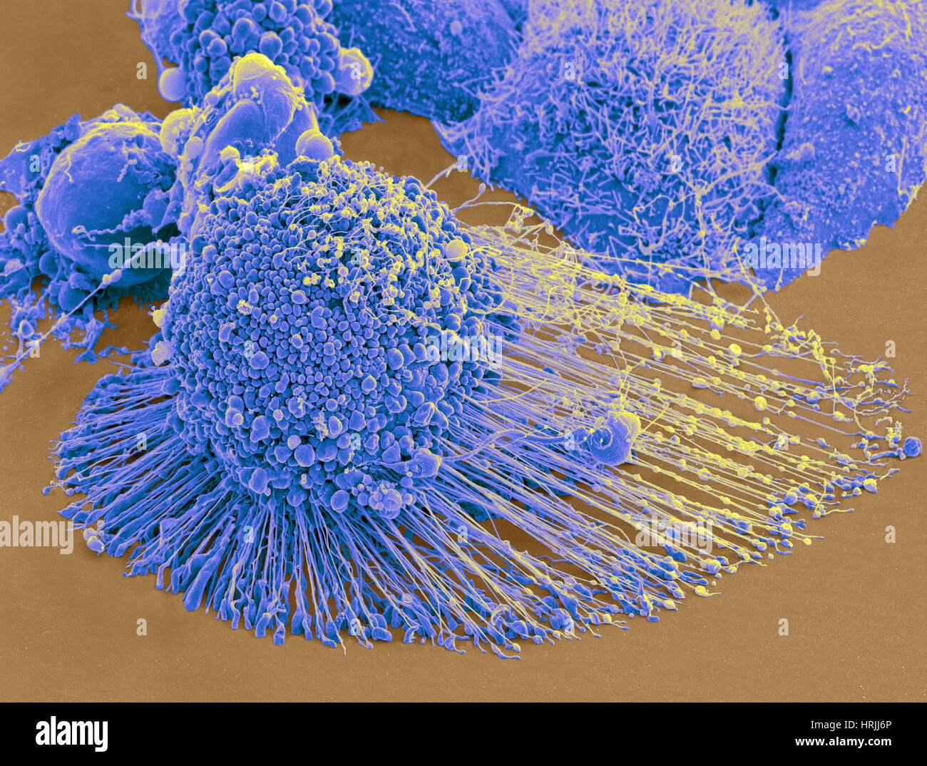 Morte delle cellule cancerogene sem immagini e fotografie stock ad alta ...