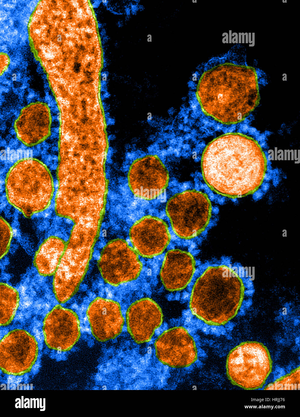 MERS-CoV, Betacoronavirus, TEM Foto Stock