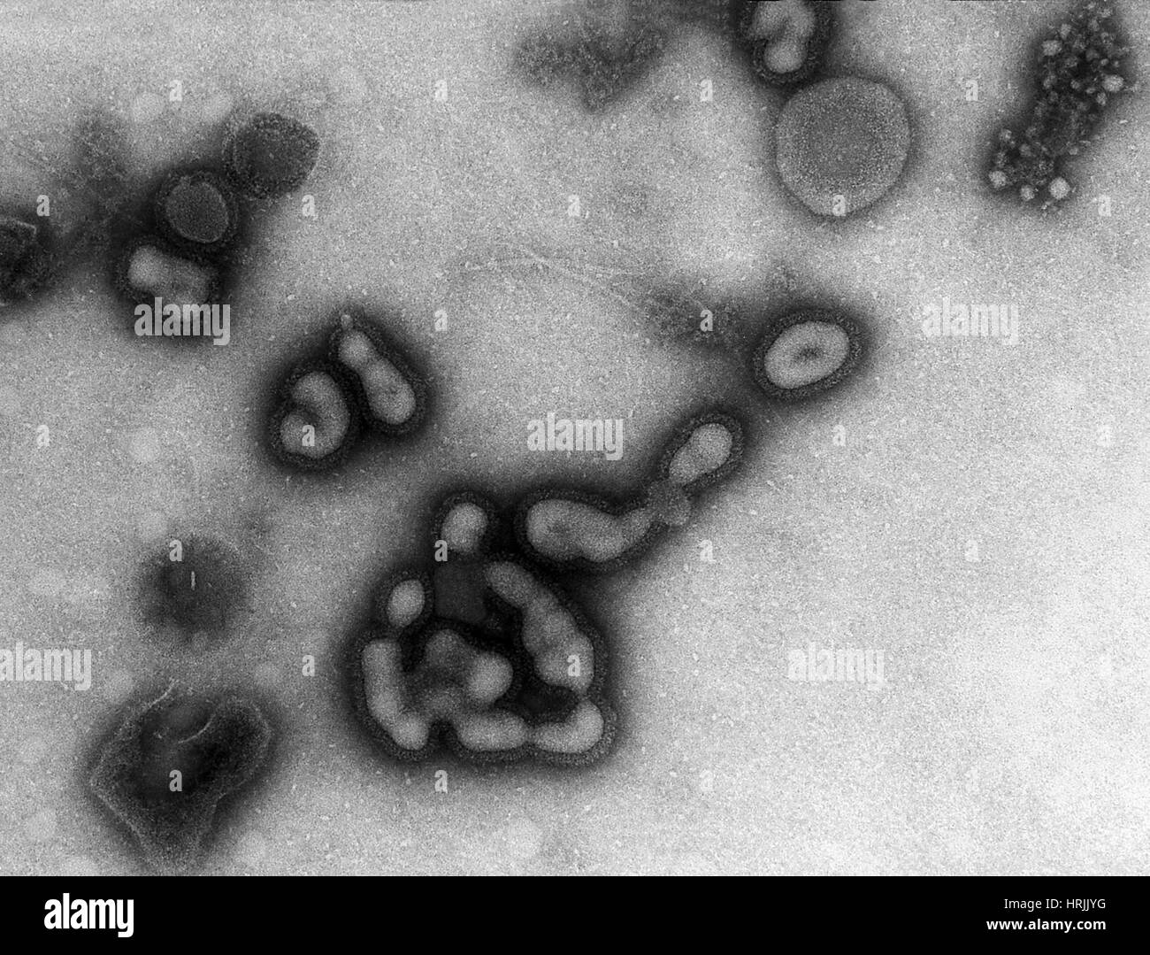H1N1, dell'influenza A, influenza russa, TEM Foto Stock