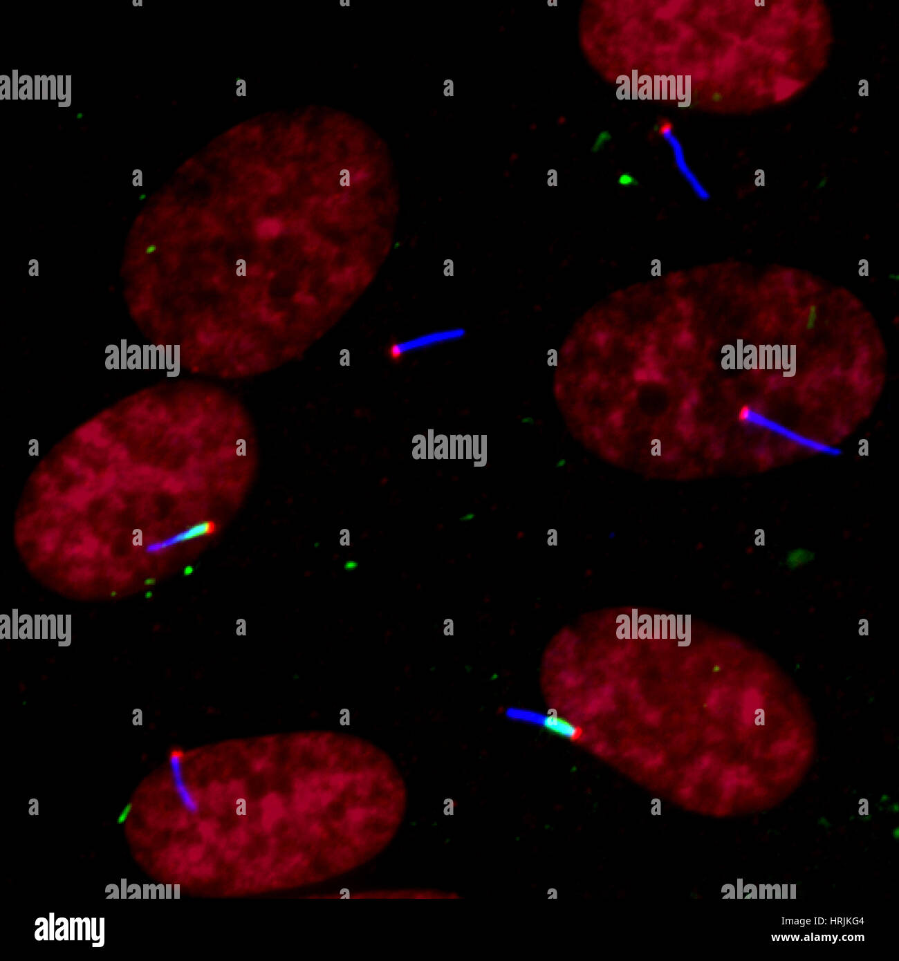Ciglia e tasca ciliare, FM Foto Stock