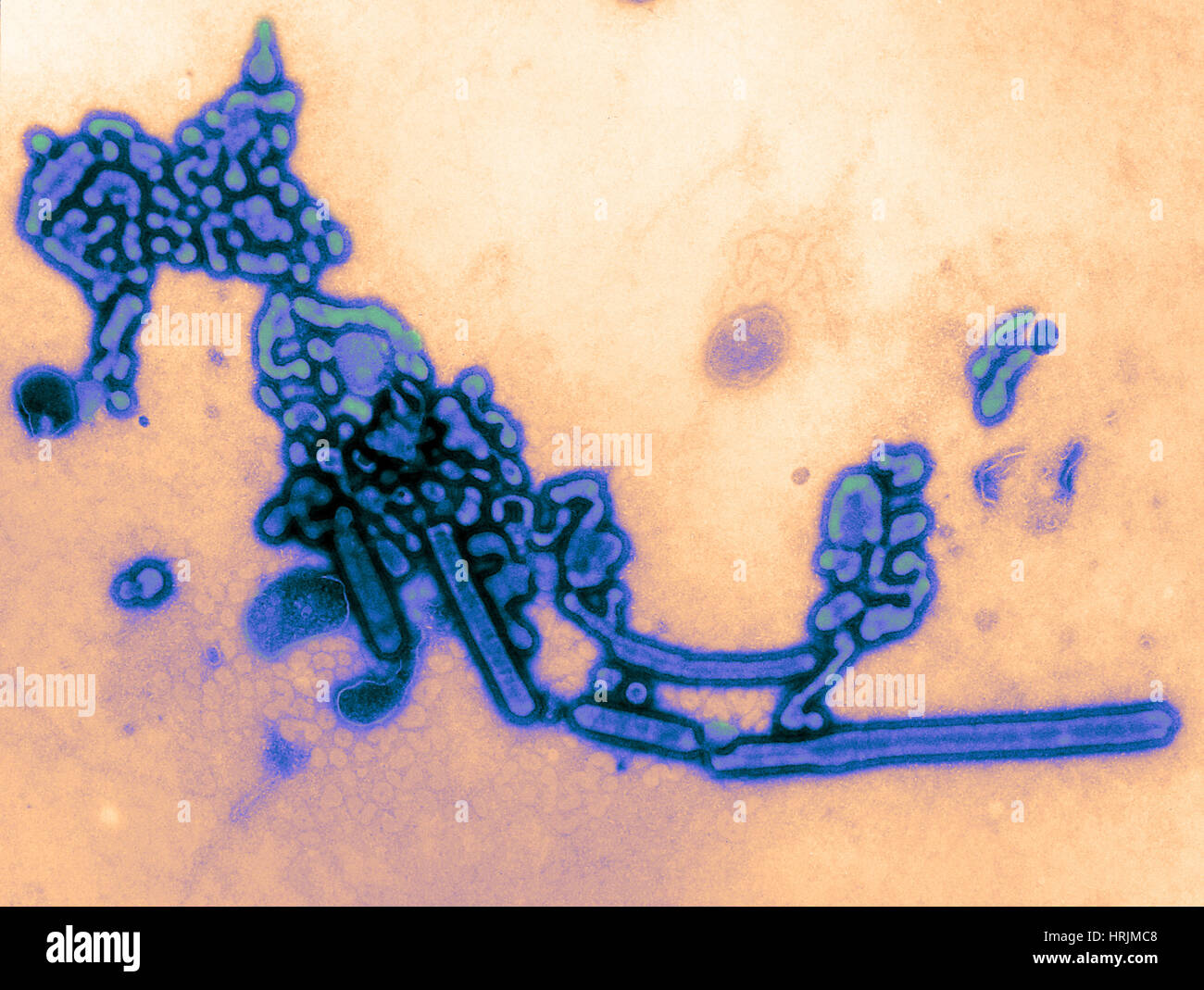 H1N1, dell'influenza A, influenza russa, TEM Foto Stock