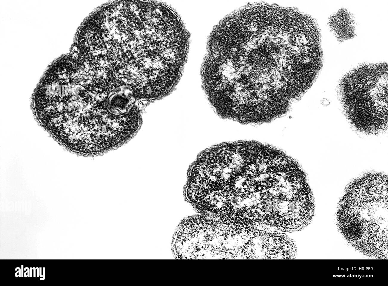 Neisseria gonorrhoeae batteri, TEM Foto Stock