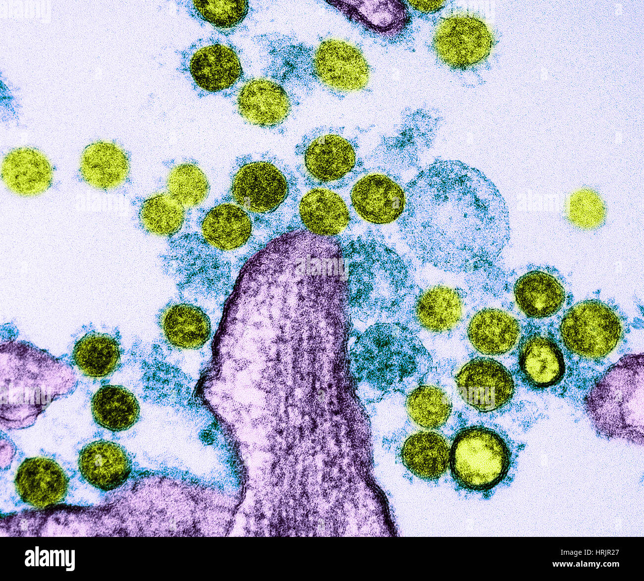 Meri Coronavirus particelle, TEM Foto Stock