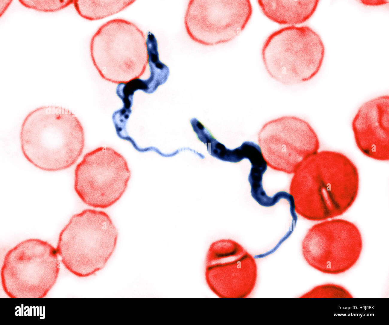 Trypanosoma gambiense, LM Foto Stock