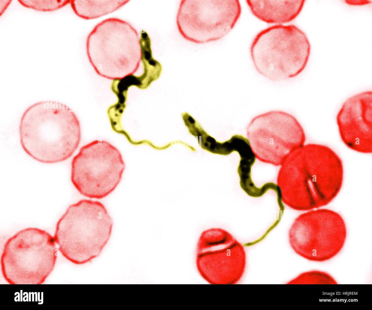 Trypanosoma gambiense, LM Foto Stock