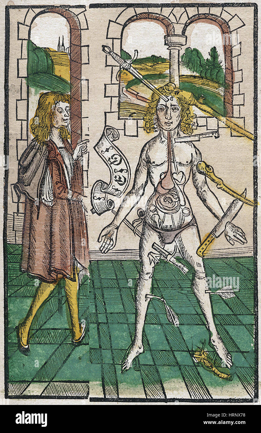 Uomo di ferita, 1512 Foto Stock