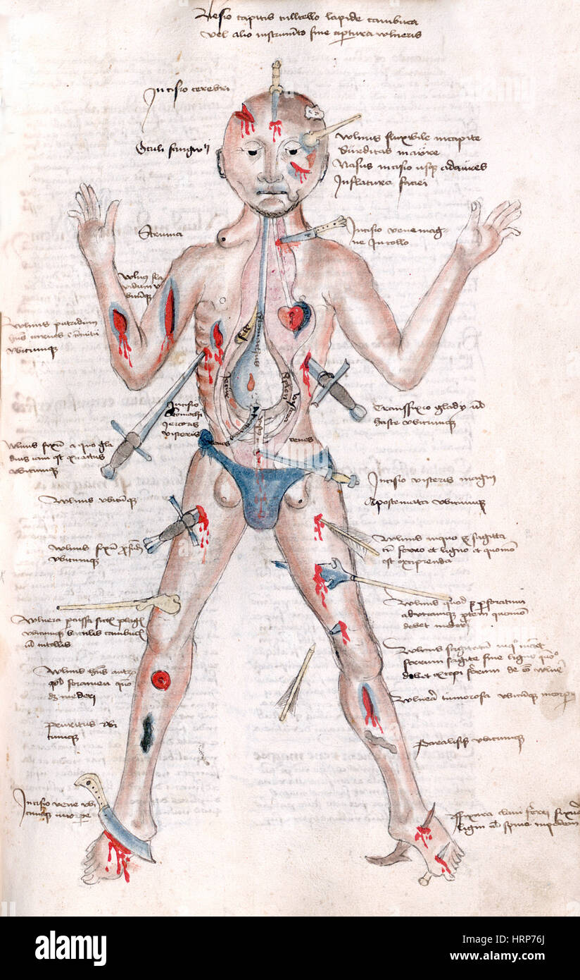 Uomo di ferita, 1485 Foto Stock