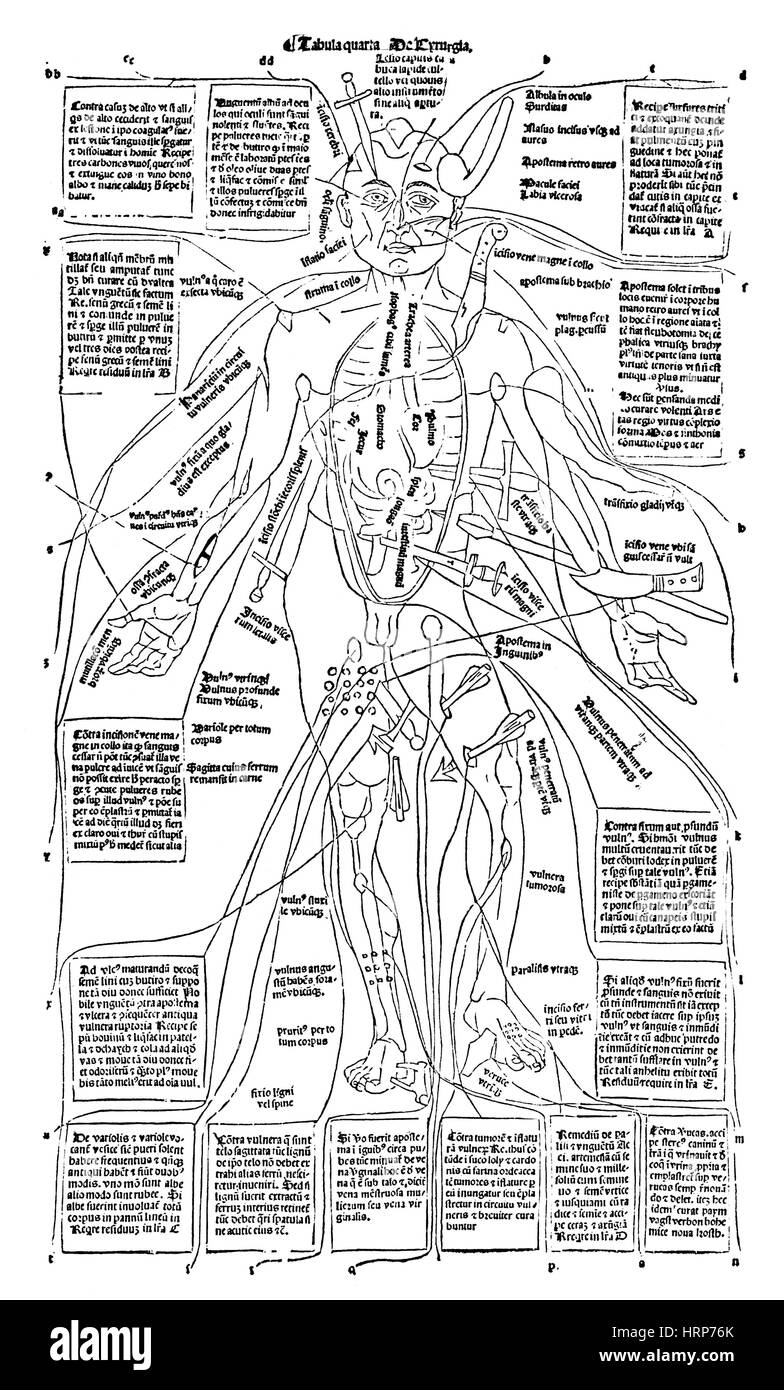 Uomo di ferita, 'Fasciculus medicinae', 1491 Foto Stock