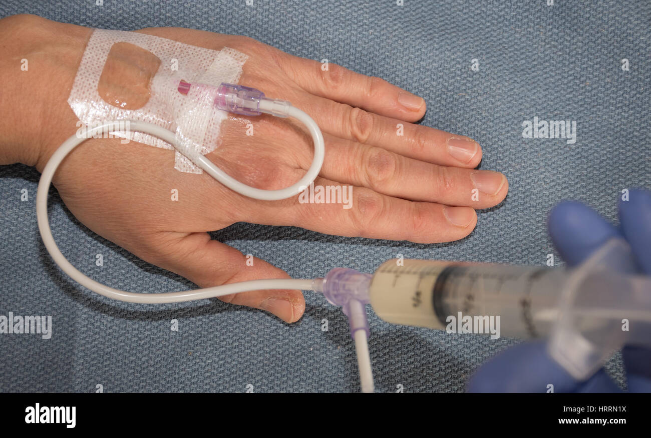Close up di un anestesista iniezione di propofol, un sedativo, nella somministrazione endovenosa in un paziente della mano destra che è su un blu sala operativa asciugamano. Foto Stock