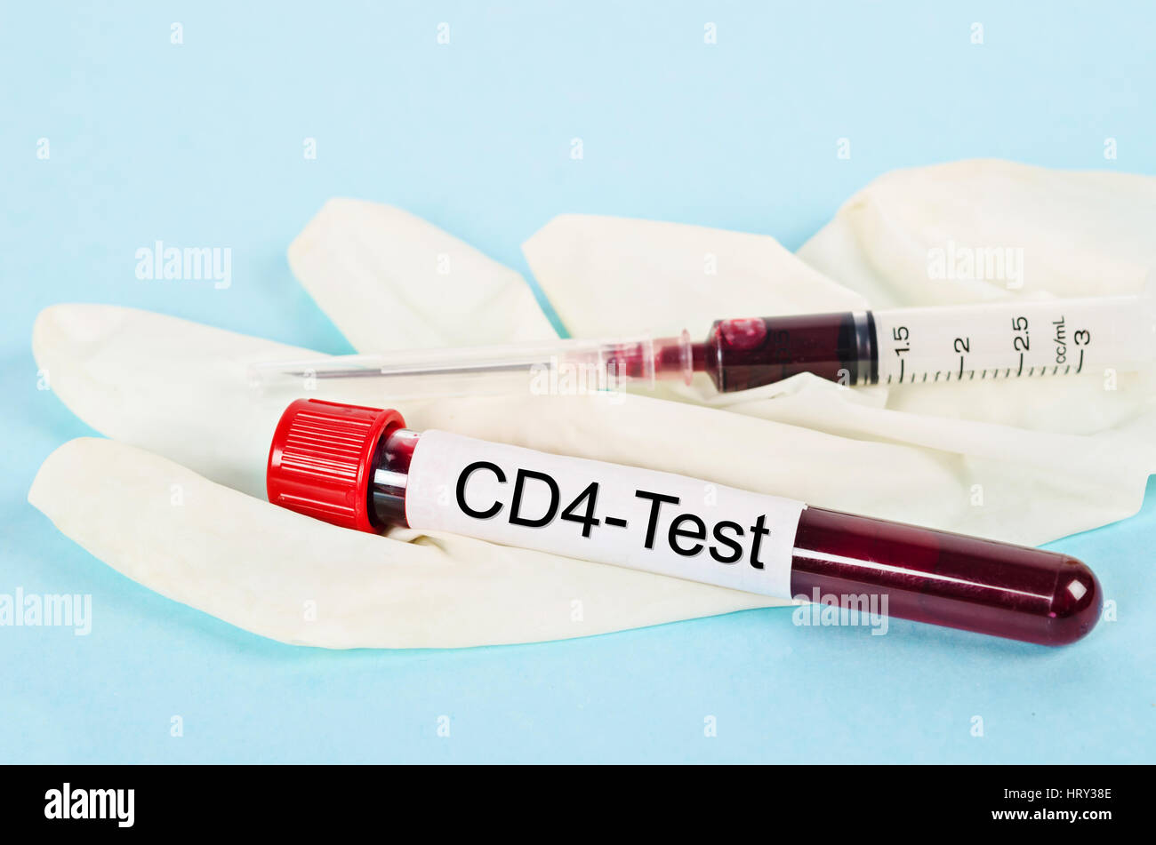 Campione di sangue nel tubo per cellule CD4, test di immunologia in cellule infettate da HIV persone Foto Stock