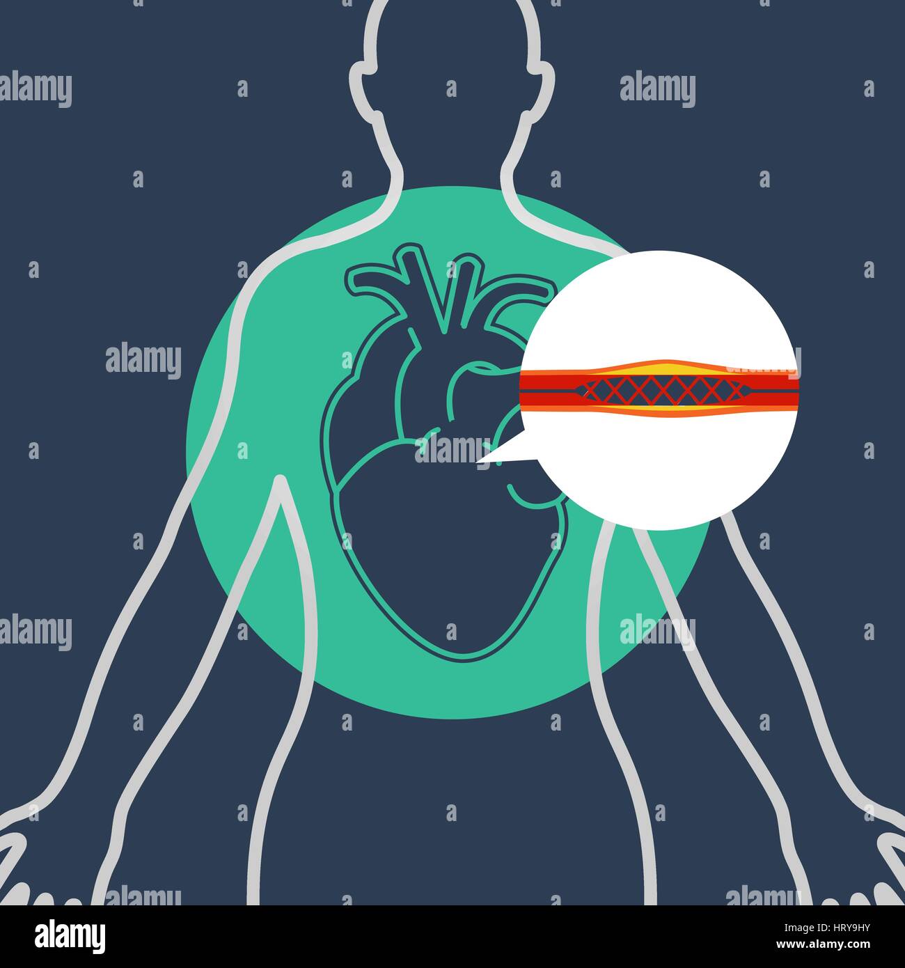 Cateterismo cardiaco vettore icona logo design Illustrazione Vettoriale