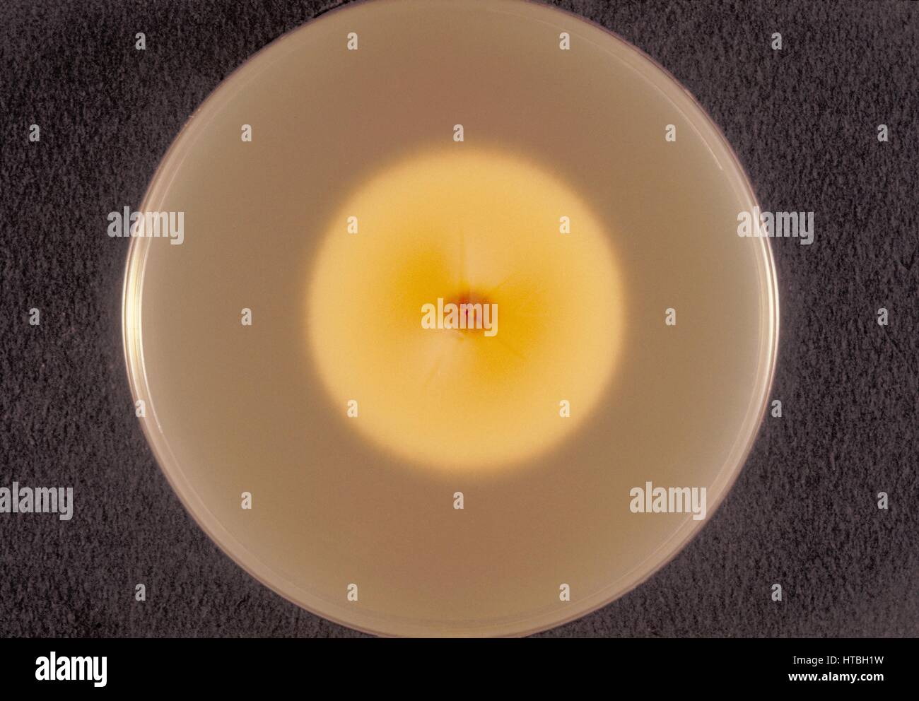 Vista inferiore, o 'verso, ' di una coltura di piastra di agar destrosio Sabouraud del fungo zoofilo microsporum persicolor, 1973. Immagine gentilmente concessa da CDC/Dr Arvind A. Padhye. Foto Stock