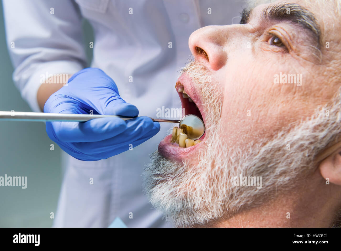 Il vecchio uomo con cattivo denti. Foto Stock
