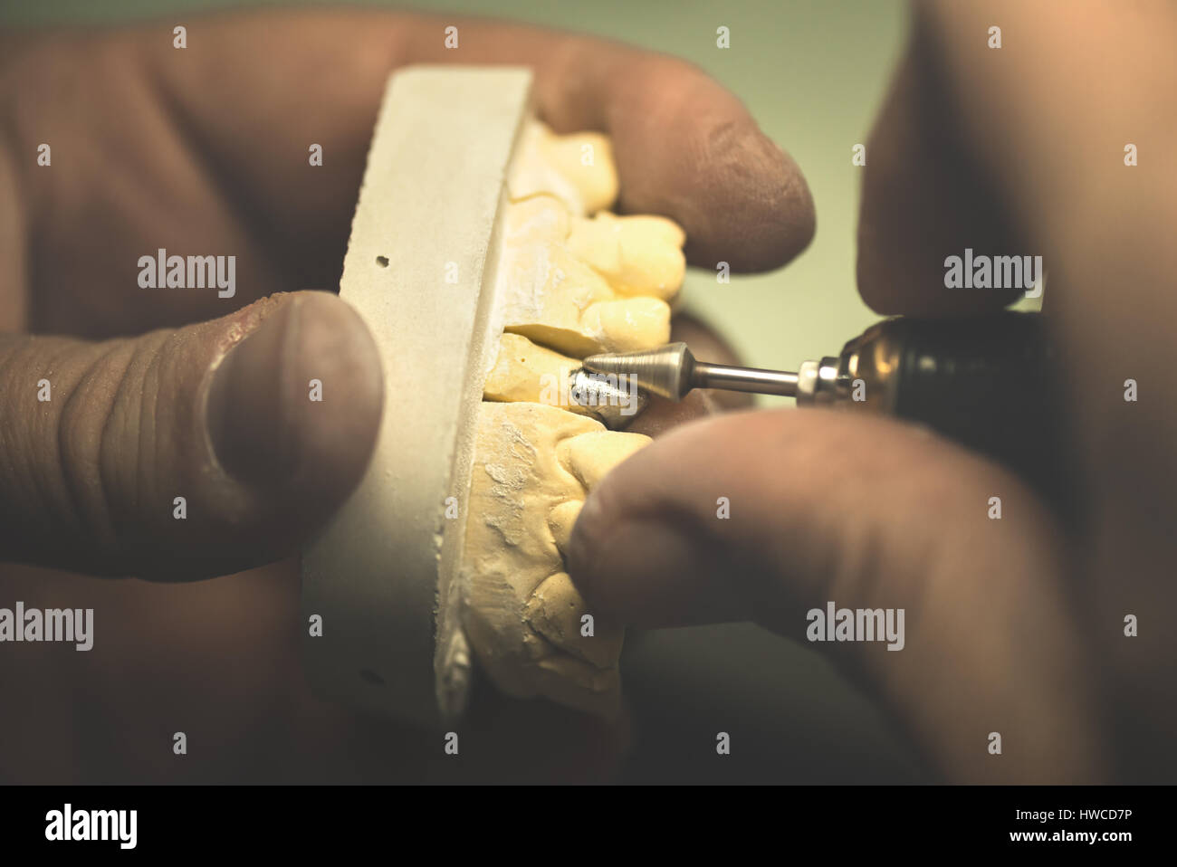 Protesi dentale, dente artificiale di protesi, mani lavorando sulla dentiera, denti finti. Foto Stock