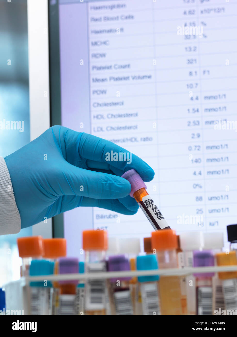 Test Medici, Haematologist controllo medico inclusi campioni di sangue per il test con i risultati sullo schermo del computer Foto Stock