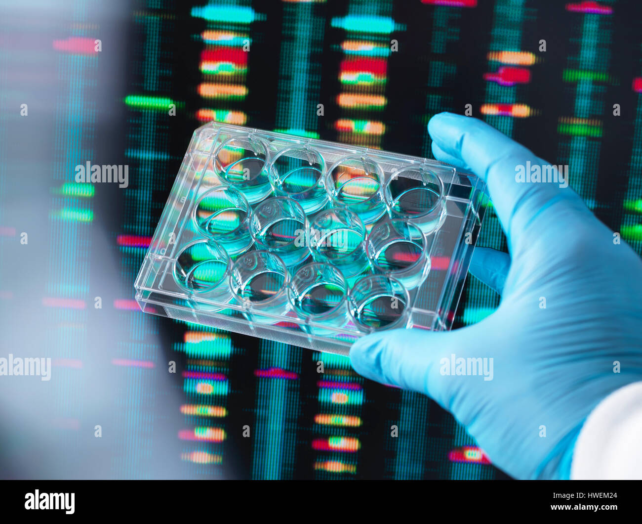 Ricerca di DNA, scienziato tenendo premuto fino a più pozzetti contenenti i campioni di DNA con i risultati sullo schermo del computer Foto Stock