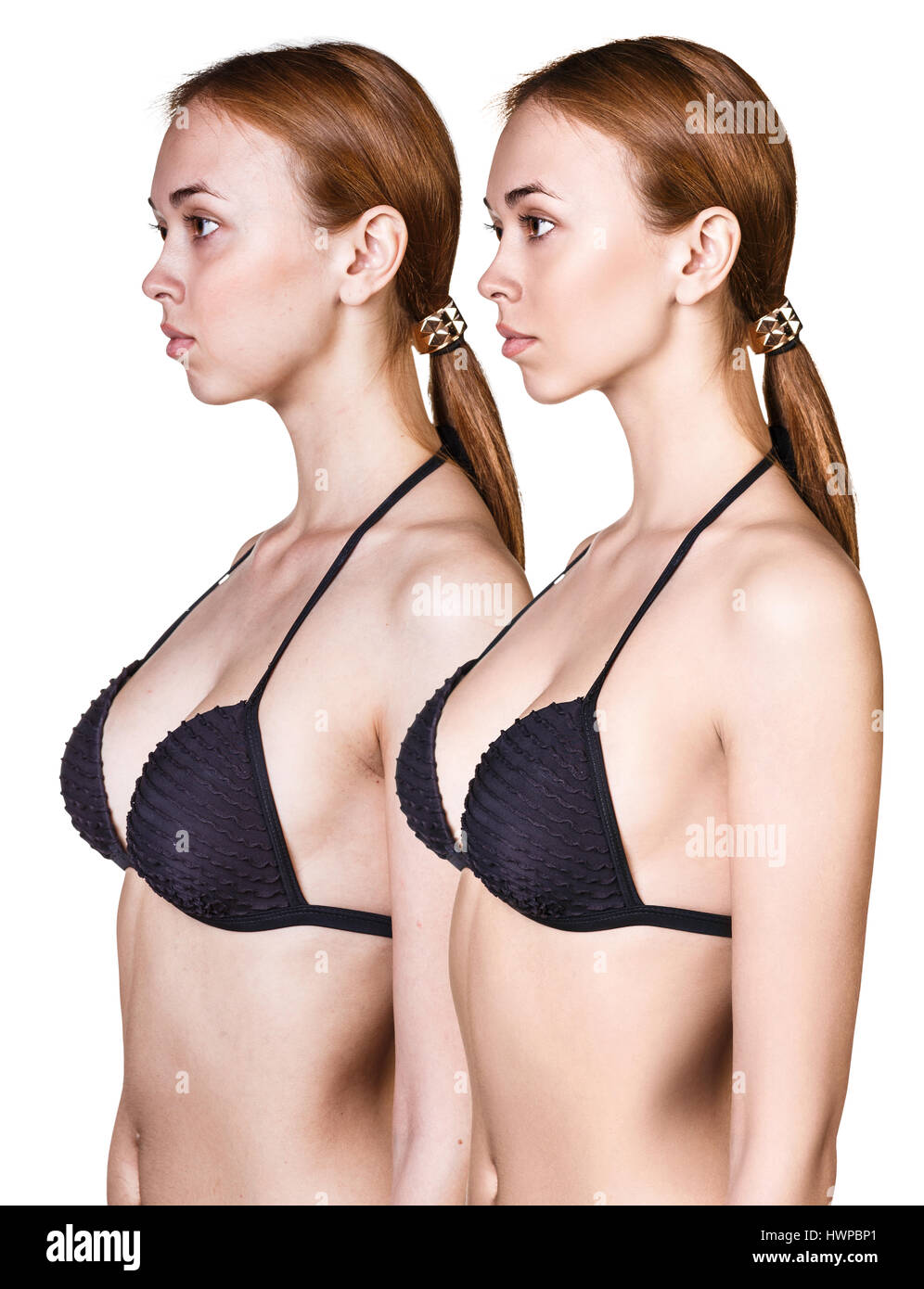 Corpo della donna prima e dopo weightloss su sfondo bianco Foto Stock