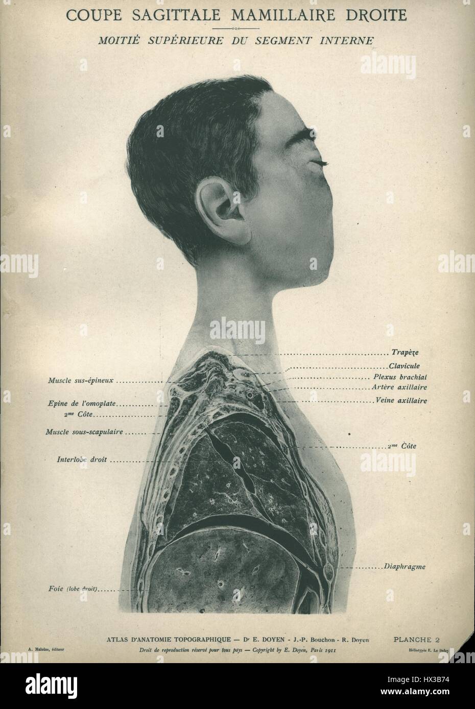 Illustrazione schematica del lato destro del corpo che mostra la sua anatomia da da Atlas d'anatomie topographique Eugene-Louis Doyen (1859-1916), 1911. La cortesia Libreria Nazionale di Medicina. Foto Stock