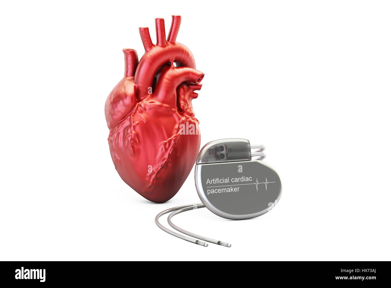 Artificiali pacemaker cardiaci, rendering 3D isolati su sfondo bianco Foto Stock