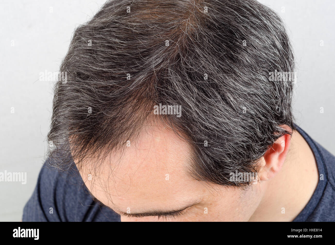 Uomo maturo la perdita di capelli problema. health care shampoo e prodotti di bellezza concep Foto Stock