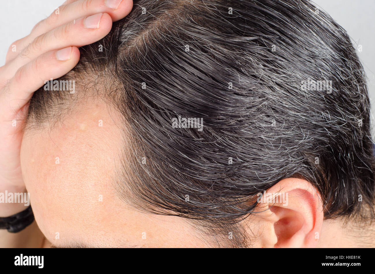 Uomo maturo la perdita di capelli problema. health care shampoo e prodotti di bellezza concep Foto Stock