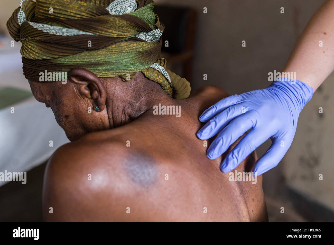 Medico sta esaminando la spina dorsale di un anziano paziente di sesso femminile in una clinica rurale in Uganda orientale Foto Stock