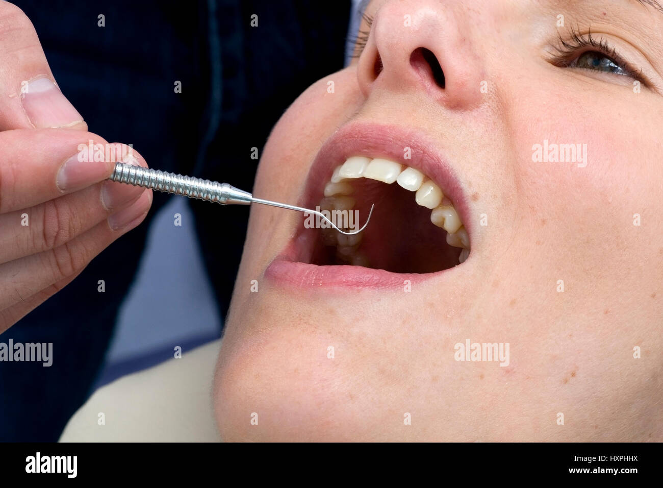 Dentista di trattamento (MR), Zahnarztbehandlung (MR) Foto Stock