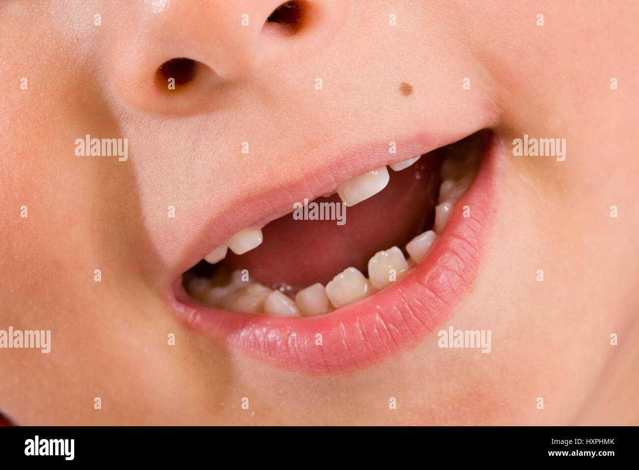 6-anno-vecchio ragazzo con gap dentale, Signor, sechsjähriger Junge mit Zahnlücke Foto Stock